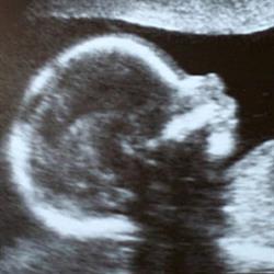 South London & Aylmer Ultrasound Services, opening hours