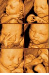 Fetal Expressions Inc, Hamilton, ON opening hours