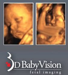 3D BabyVision, London, ON opening hours