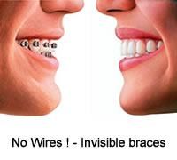 BRACES VANCOUVER - INVISALIGN, Vancouver, BC opening hours