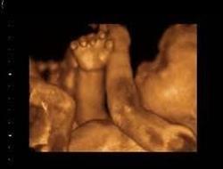 3D BabyVision 3D Ultrasound Mississauga (Square One), opening hours