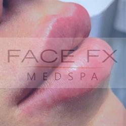 FaceFX Med Spa, Edmonton, AB opening hours