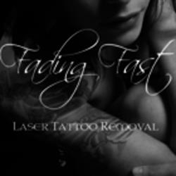 Fading Fast Laser Tattoo Removal, Toronto, ON opening hours