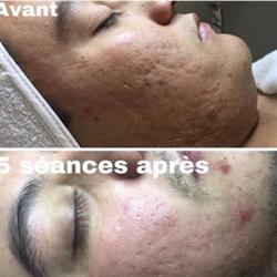 Clinique 5 Dimensions - Épilation laser, Soins de la peau, Microneedling Saint-Jérôme, opening hours